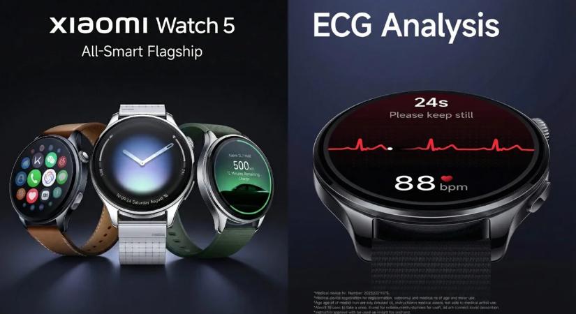 Elképesztően izgalmas lesz a Xiaomi új okosórája