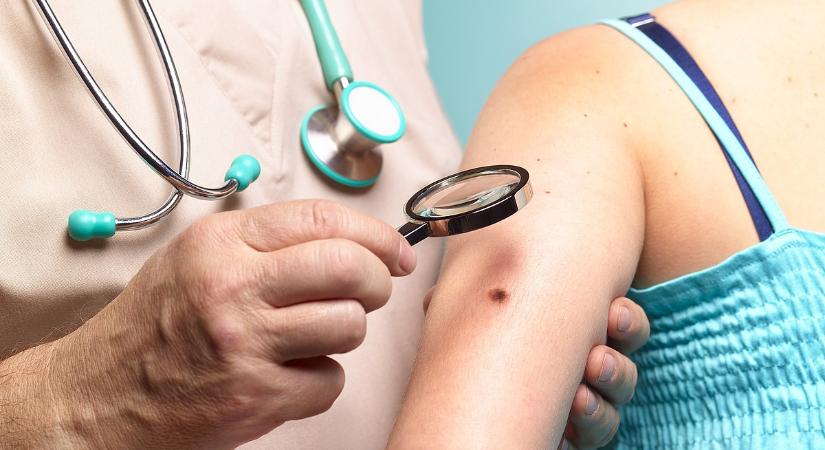 Áttörést hoz a LED a rákgyógyításban? Röpke fél óra alatt elpusztította a bőrrák túlnyomó részét ez a felfedezés