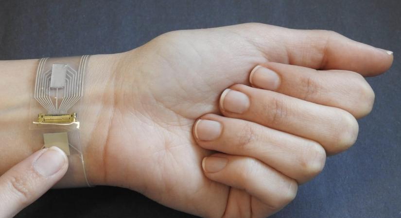 Remény cukorbetegeknek: csuklón viselhető mindent mérő eszköz