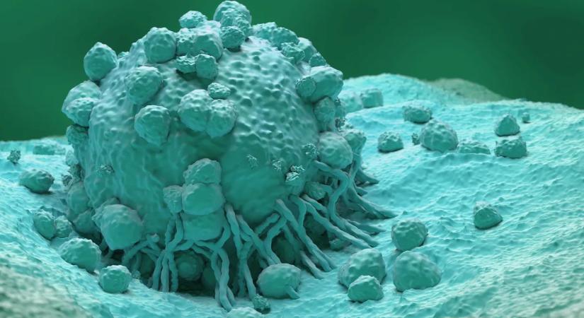 Ez a tevékenység drasztikusan megnöveli a halálos rákfajta kockázatát