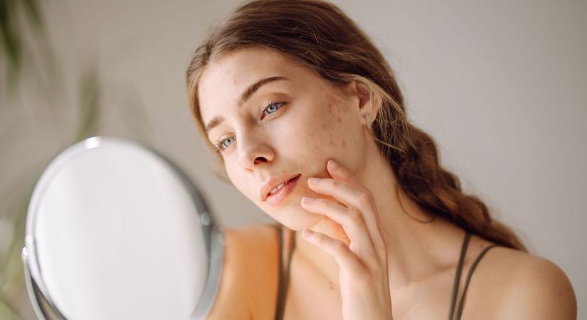 Meglepő, mennyit számít az étrend: így teheted selymesen hidratálttá a bőröd télen