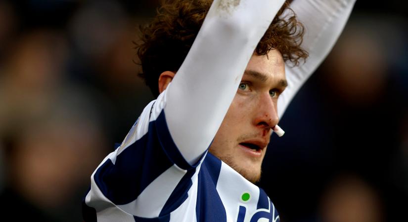 Eltörhetett a magyar légiós orra az angol bajnokin