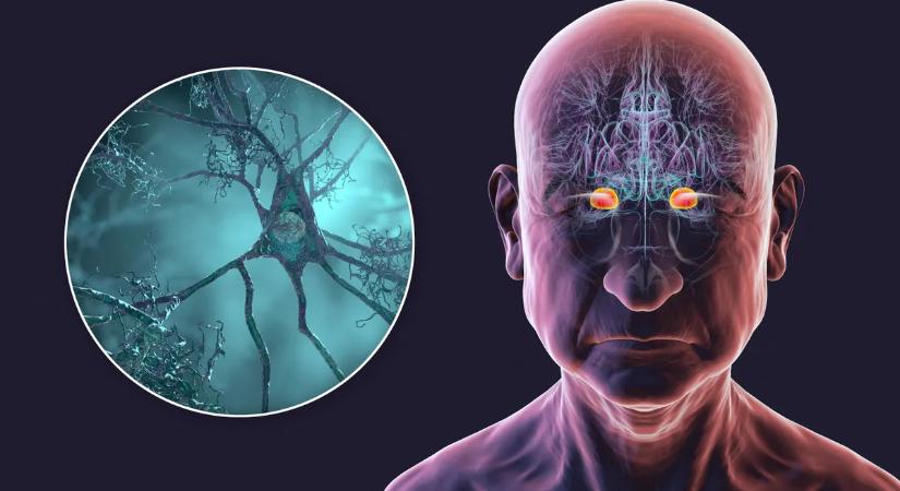 Megvan az étel, ami védhet a demencia ellen