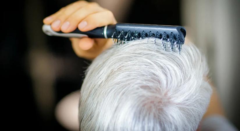 Megvizsgálták, miért őszülünk valójában; megdöbbentő eredményre jutottak