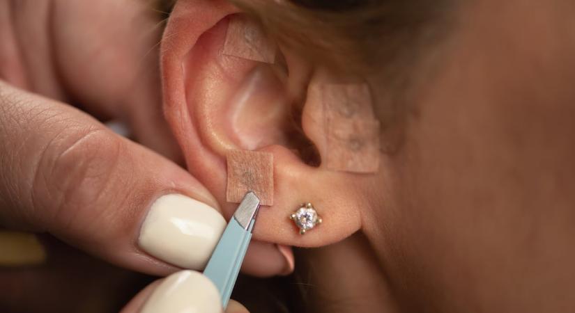 A fül akupresszúra: valóban segít a stressz és szorongás ellen?