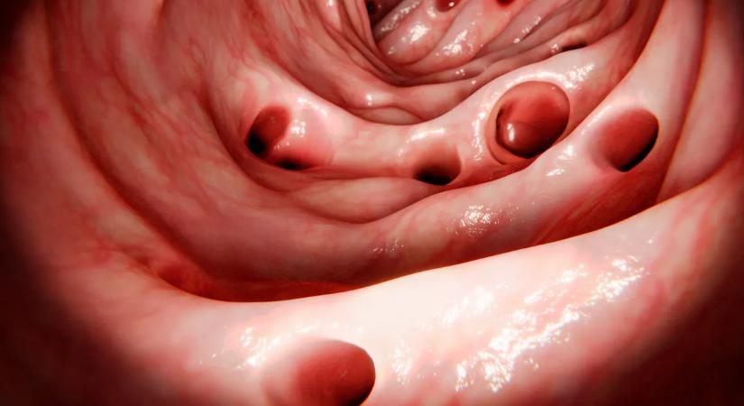 Ez a betegség szinte mindenkit érinteni fog – így készülhetünk fel rá