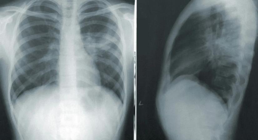 "Állandóan szorongtam és fáradt voltam... a zsúfolt életemet hibáztattam, de egy sokkal baljósabb betegségről volt szó"