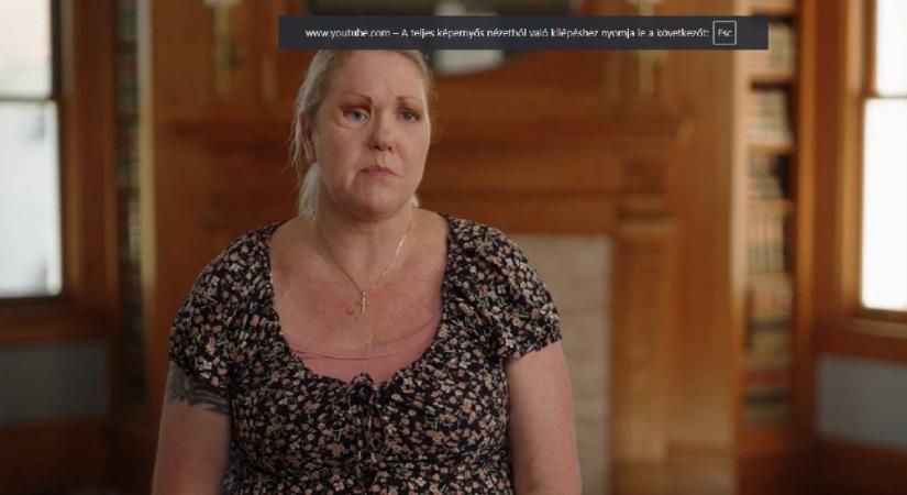 „Megette az arcát” egy fertőzés, miután autóbalesetet szenvedett a nő