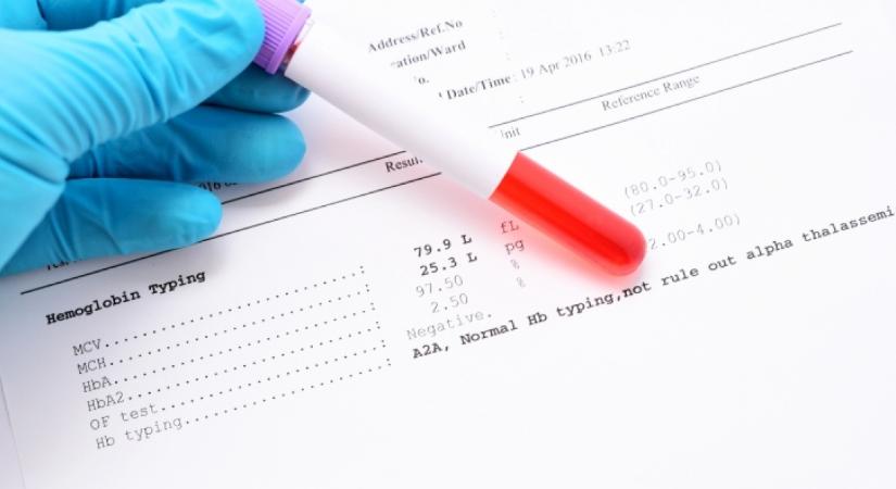 Nem a koleszterin az: ez az érték árulkodik valójában a laborleleten a szív állapotáról