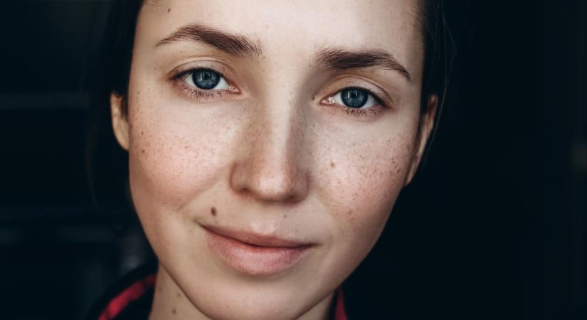 A tested rejtett üzenetei: mit mondanak az anyajegyeid az előző életedről?