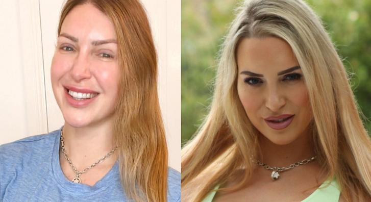 Több mint 50 milliót költött plasztikai műtétekre, mára megbánta, hogy valaha kés alá feküdt