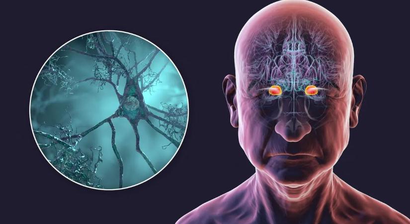 Megvan az étel, ami védhet a demencia ellen