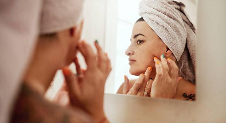 Ha itt van az arcodon pattanás, semmiképp se nyomd ki