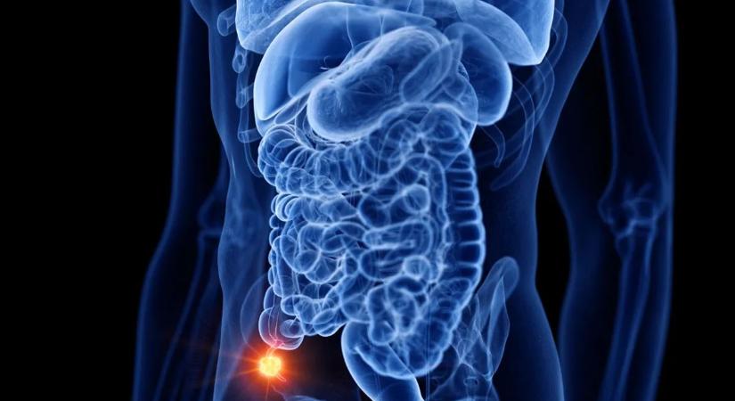 Kiadták a figyelmeztetést: megugrott egy ritka rákfajta előfordulása a fiatalok körében