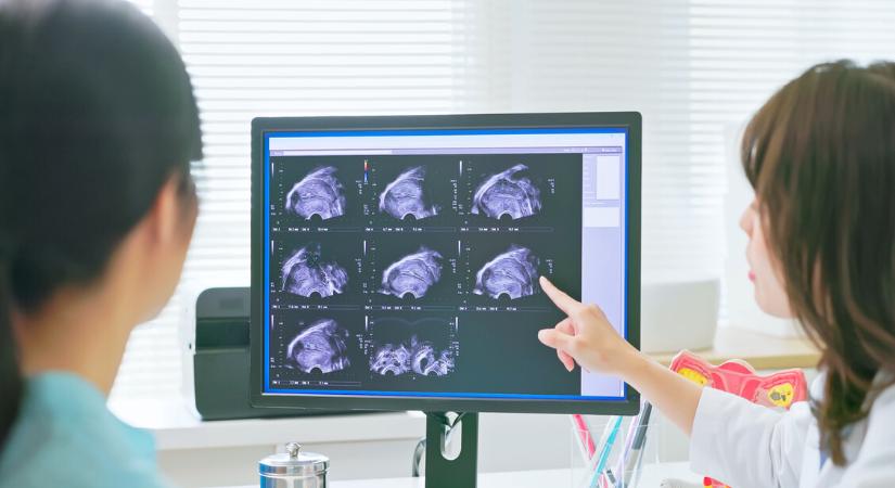 Remény endometriózis-gyanúnál: egyszerűbb lesz diagnosztizálni a betegséget?