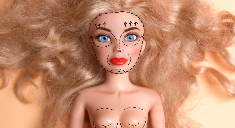 Ez a bizarr beavatkozás lesz 2026 legnépszerűbb plasztikatrendje