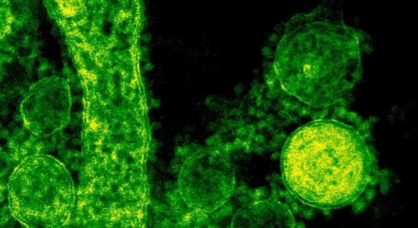 A tudósok világszerte terjedő fertőző, gyilkos gombára figyelmeztetnek