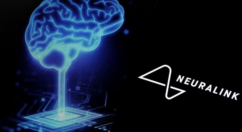 Elon Musk őrült ígérettel állt elő: tömegtermékkel mászna bele az agyunkba, már orvos sem kell a beültetéshez