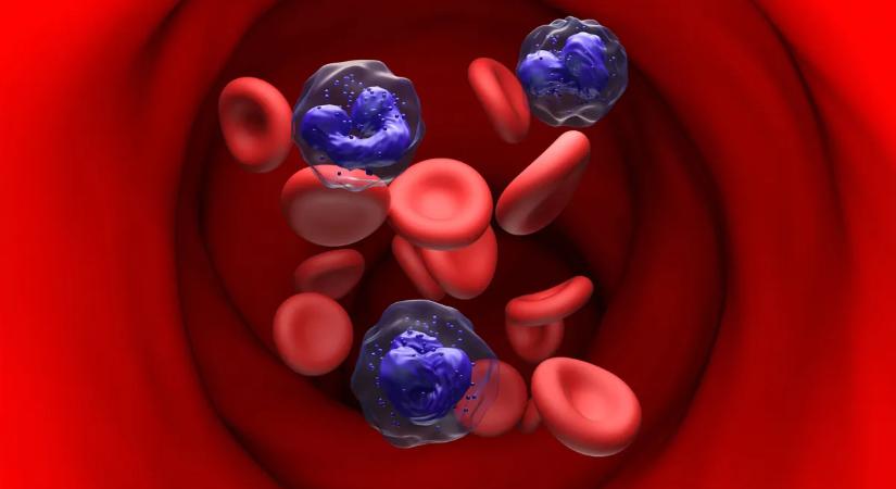 Ez lehet a leukémia legelső jele, amit eddig senki sem vett észre