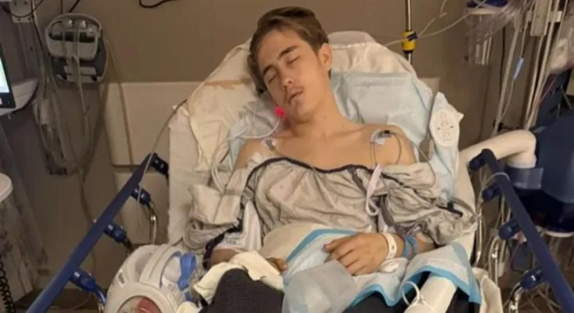 Csak segíteni akart, elgázolták a 16 éves fiút – „Nagyon hosszú út áll még előttünk”