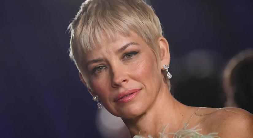 Agykárosodást szenvedett a Marvel-filmek sztárja – rengetegen aggódnak érte