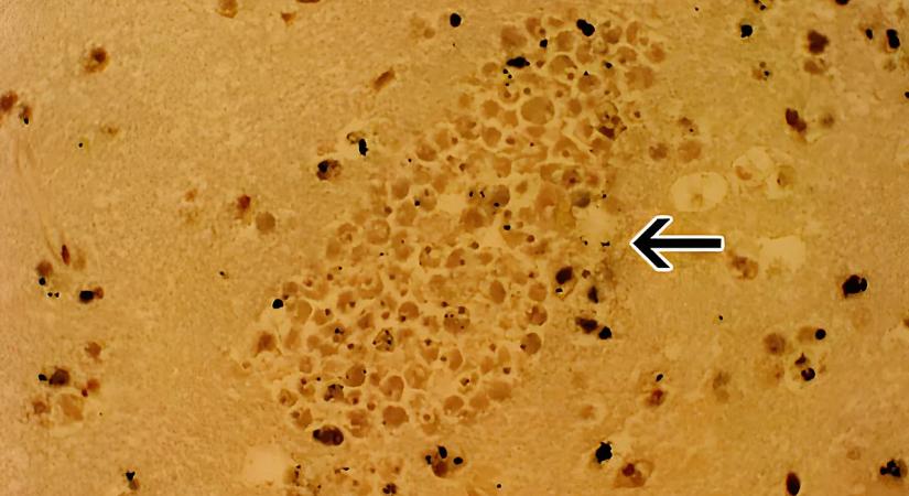 A csapvíz is életveszélyessé válhat – sokkoló figyelmeztetés érkezett