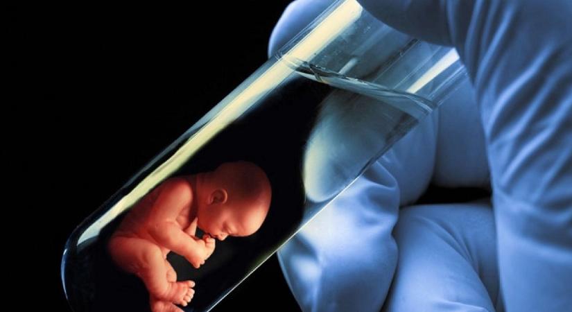 „Az egészségügyi államtitkár fordítva ül a lovon” – írja a vidéki orvos posztjában