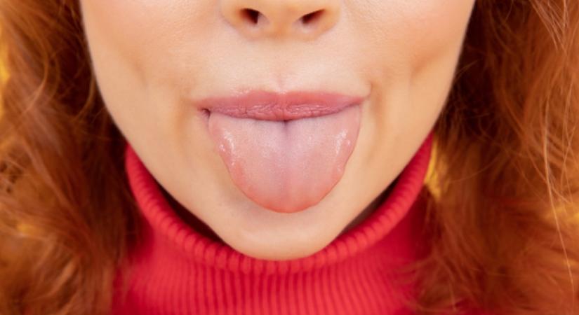 Ha ezt a jelet látod a nyelveden, nagy baj közeleg: ne hagyd figyelmen kívül