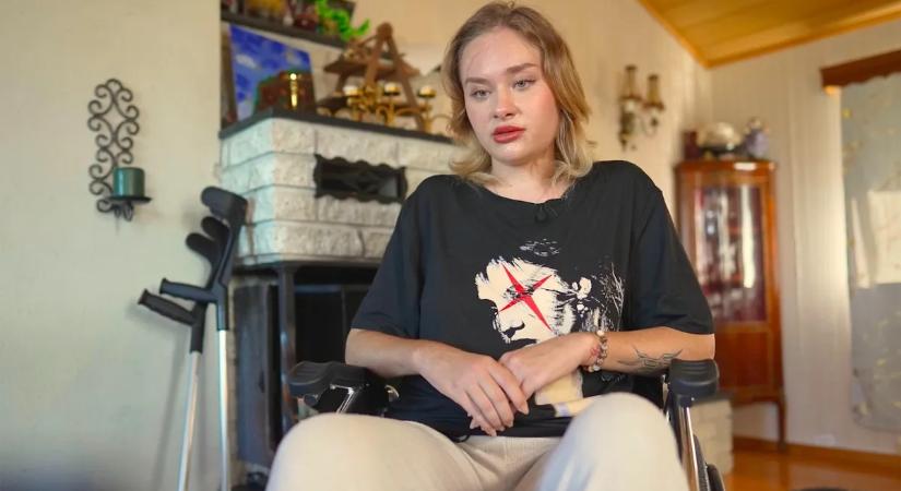 Újra járni kezdett az ukrán modell, akit brutálisan megvertek egy dubaji szexpartin