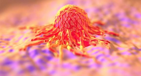 Ultrahanggal aktivált tumorellenes gyógyszerek