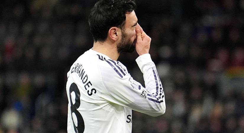 PL: a kiesőjelölt Burnley otthonában sem tudott nyerni a Manchester United – videóval