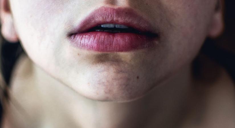 Kékül az ajkad vagy az ujjad? Ne vedd félvállról, komoly problémára utalhat