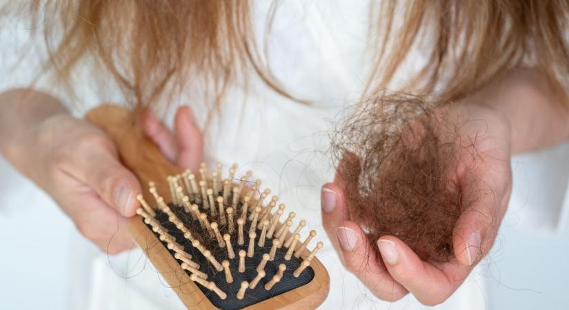 Mennyi hajhullás számít normálisnak naponta?