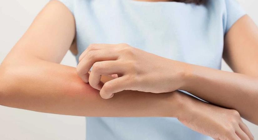 Rühesség a kórházban