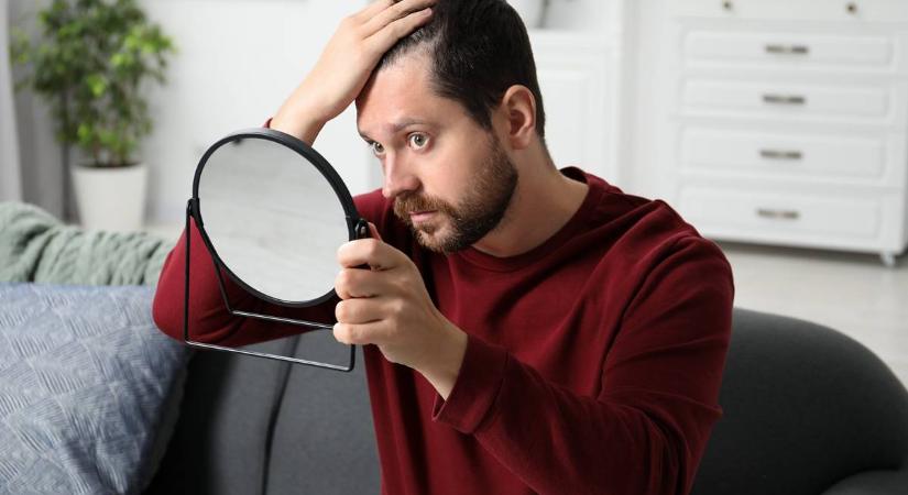 Jó hír a kopaszodó férfiaknak, hajnövesztő csodaszert mutattak be tajvani kutatók