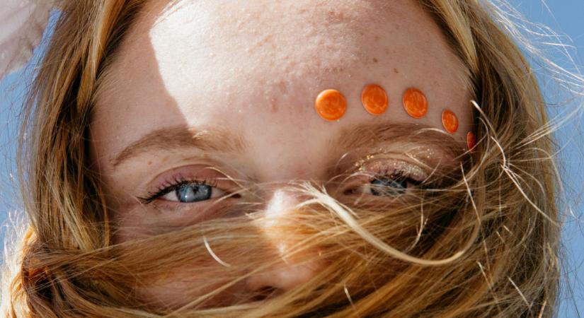 Bőrgyógyászok figyelmeztetnek: 5 népszerű étrend-kiegészítő, ami valójában árthat a bőrödnek, és te nem is gondolnád