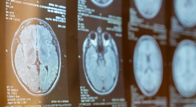 A légzésünk ugyanolyan egyedi, mint az ujjlenyomatunk