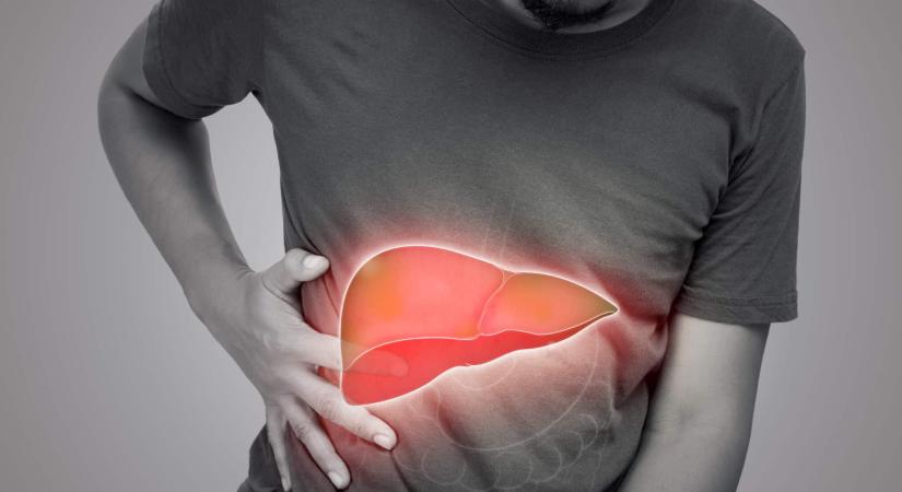 Hiába nem iszol alkoholt, sok magyar másik kedvence is napi szinten károsíthatja a májat