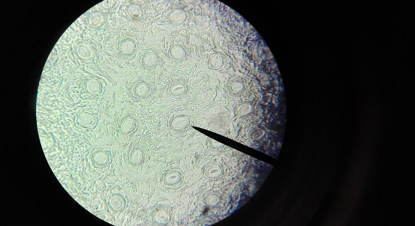 156 éve született az embrionális szervátültetés úttörője