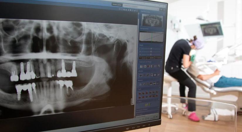 Soha többé implantátum? Hatalmas fordulat jöhet a fogászatban