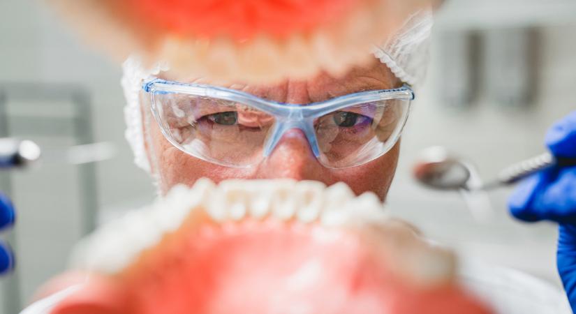 Leáldozhat az implantátumok kora, óriási fordulat jön a fogászatban