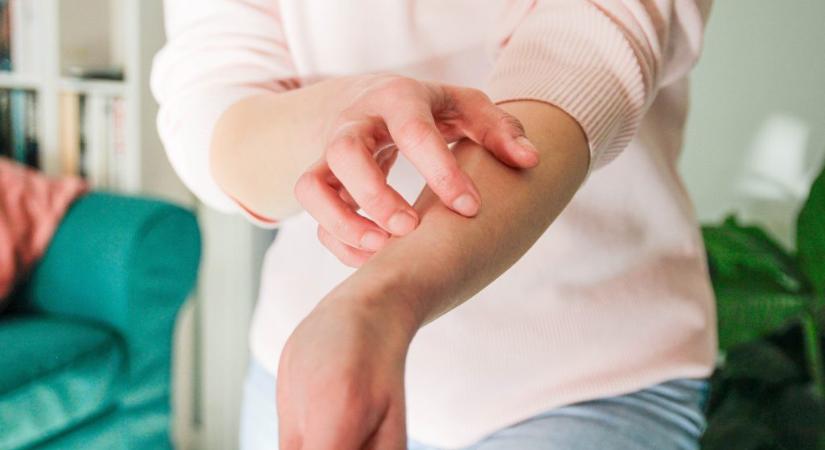 Ez a teendő, ha bőrpanaszaink vannak a téli hidegben