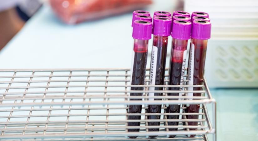 Ezek a laborértékek utalhatnak daganatos betegségre