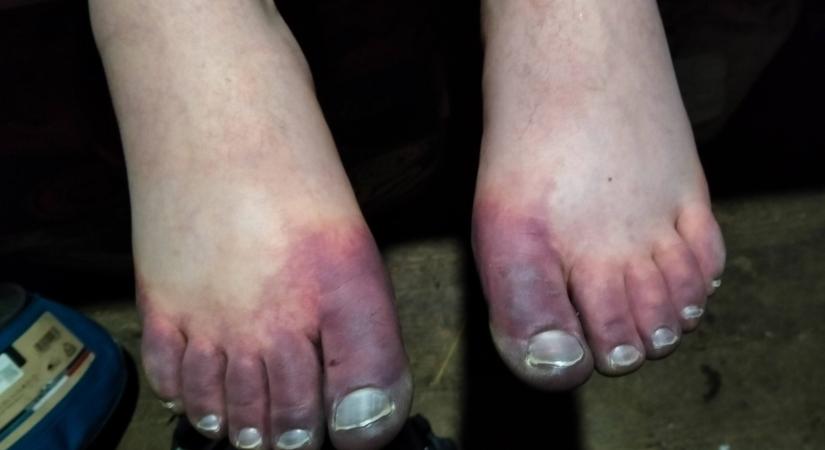 23 éves odesszai turista szorult segítségre a Hoverla közelében