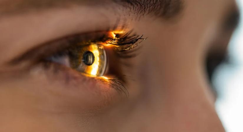 Születése óta nem tud pislogni a lány – hihetetlen, mi változtatta meg az életét