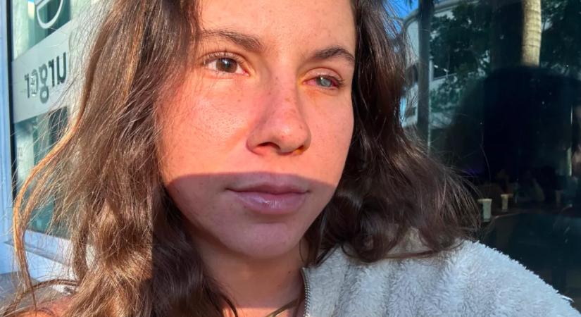 Paradicsomi nyaralásból rémálom: parazita falta fel Vivi szemét