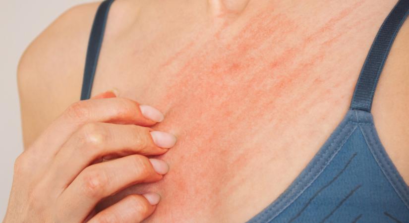 Kínzó népbetegség tünetei súlyosbodhatnak a borzasztó hidegben: rengeteg magyar szenved tőle, ez lehet a megoldás