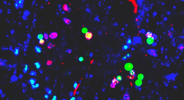 Az agyunkra mennek a mikroműanyagok? Súlyos tévedéseken alapulhatnak az erről szóló kutatások