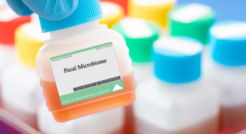 Szarátültetés mentett meg egy férfit, akinek a bele alkoholt termelt