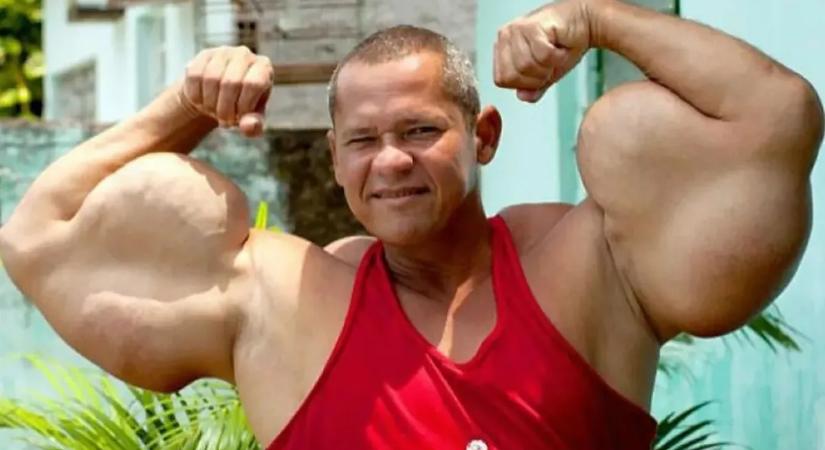 Meghalt a brazil Popeye